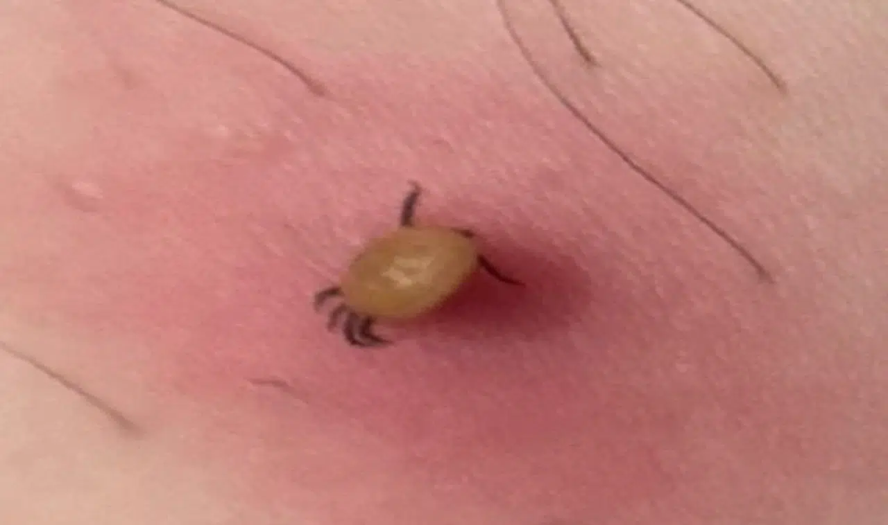 Kene ısırığına dikkat!