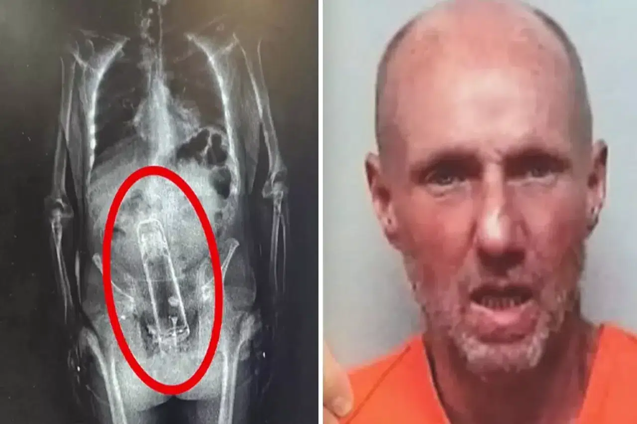 X-Ray'de fark ettiler! Adamın içinden çıkan polisleri şaşkına çevirdi