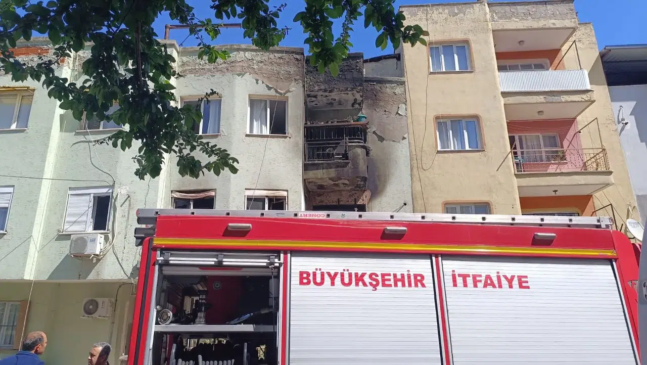Bir yıl önce yangında yaralanmıştı! Yaşam mücadelesini kaybetti