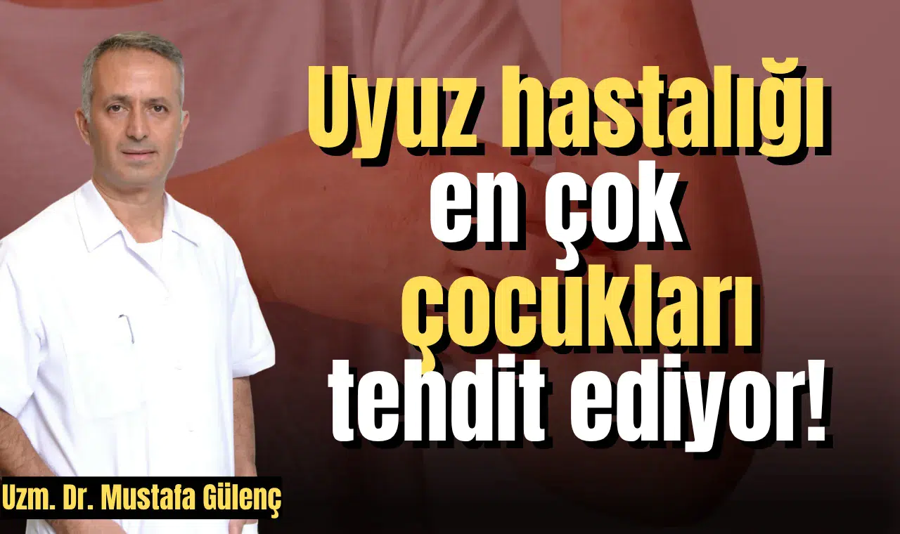 Uyuz hastalığı en çok çocukları tehdit ediyor!