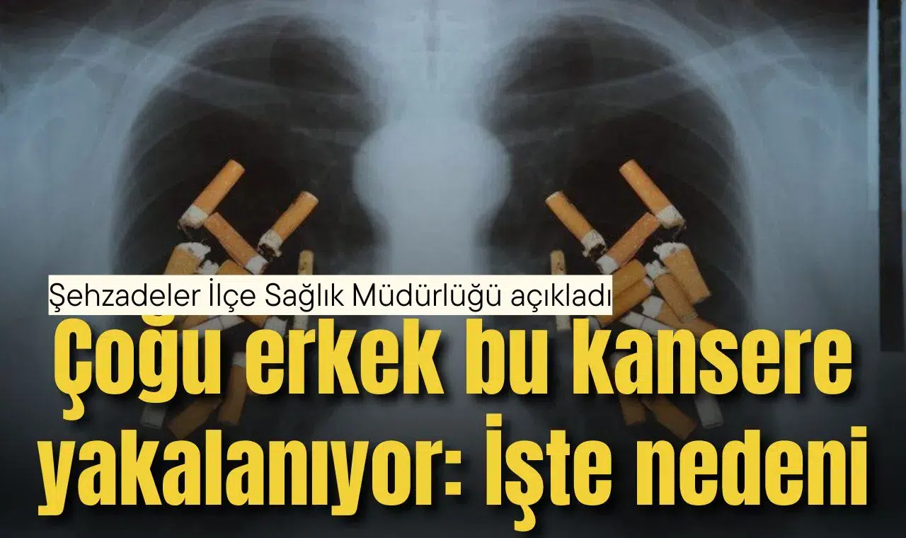 Çoğu erkek bu kansere yakalanıyor: İşte nedeni