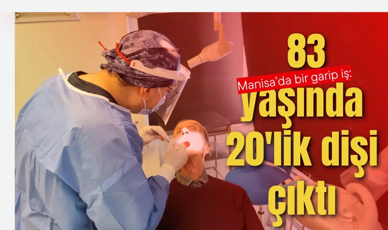 Manisa'da bir garip iş: 83 yaşında 20'lik dişi çıktı