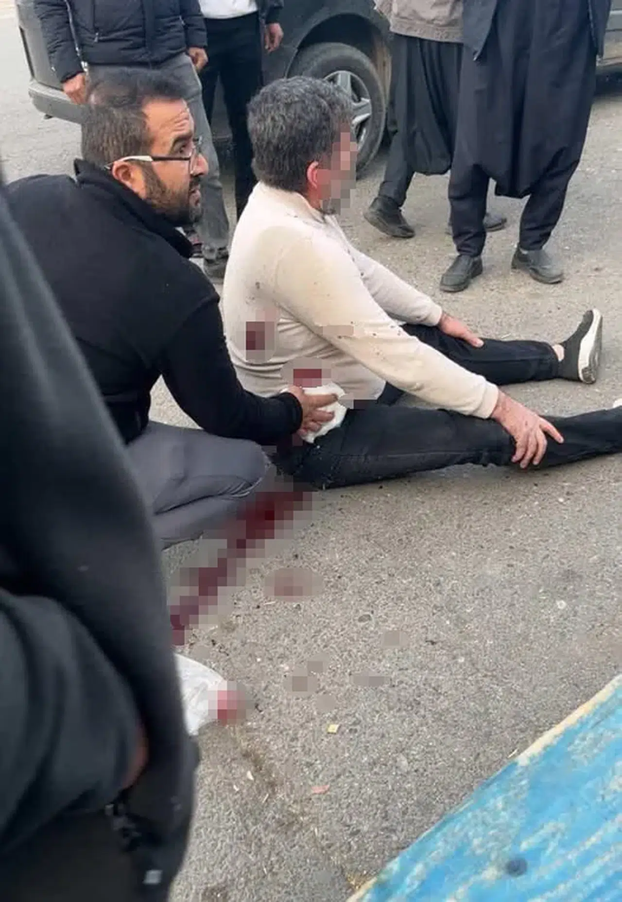 Bıçaklı kavga: 1 yaralı