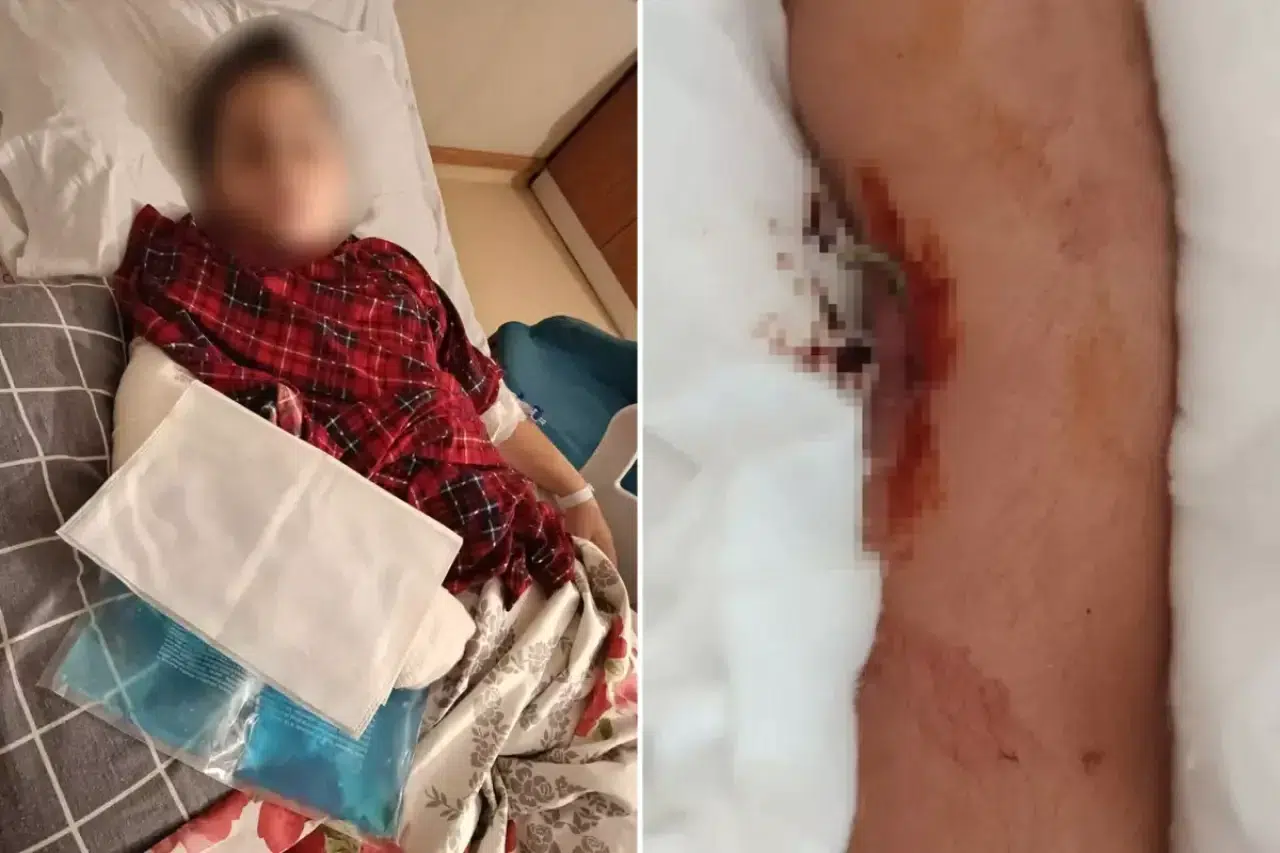 9 yaşındaki çocuk, 8 yaşındaki çocuktan böyle intikam aldı