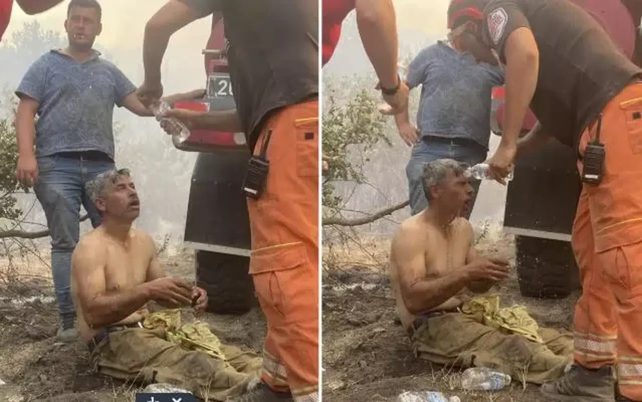 "Yanıyorum!" diyerek feryat eden orman işçisinin son hali: Eşi paylaştı