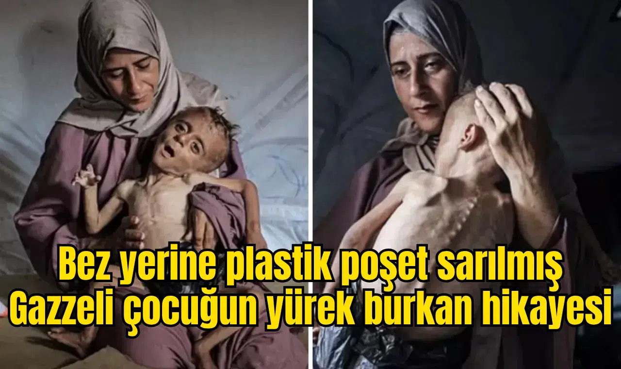 Bez yerine plastik poşet sarılmış Gazzeli çocuğun yürek burkan hikayesi