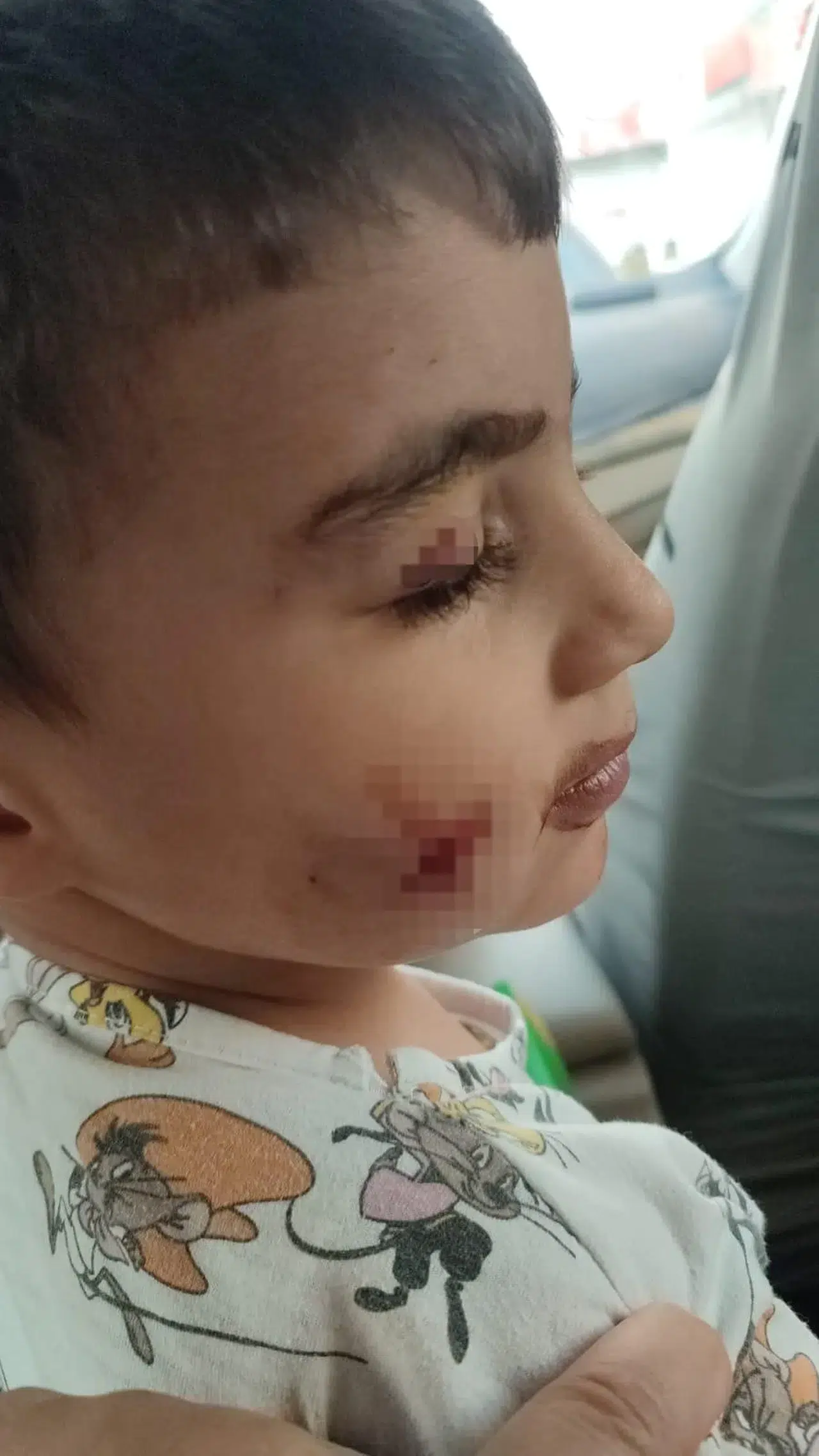 Minik çocuk lağım faresinin hışmına uğradı