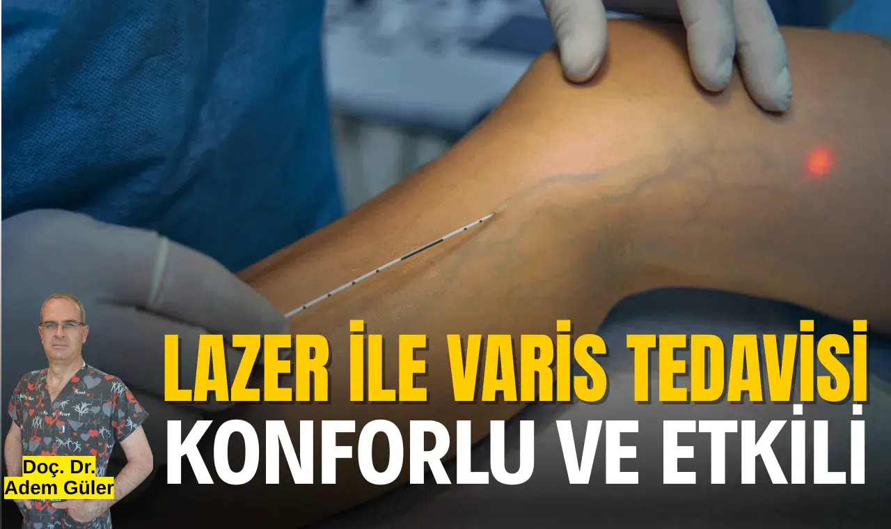 Lazer ile varis tedavisi konforlu ve etkili