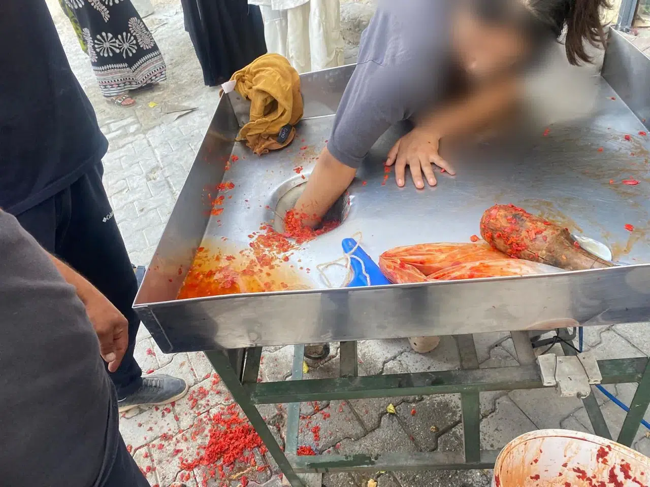 Salça yapma makinesine elini kaptırdı