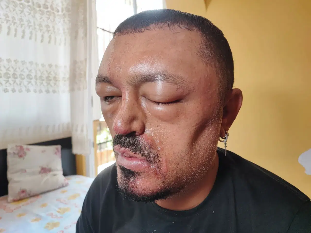 ŞAMPUANLA HAYATI KARARIYORDU!