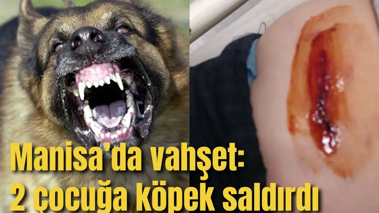 Manisa'da vahşet:2 çocuğa köpekler saldırdı