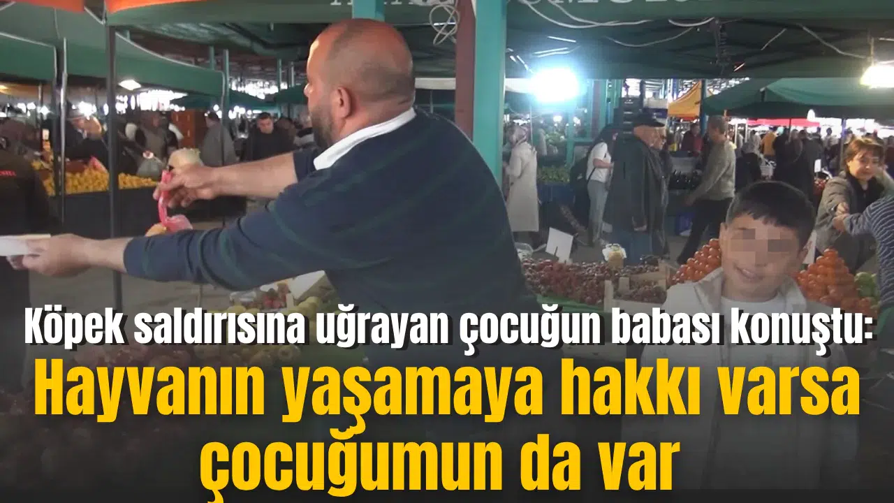 Köpek saldırısına uğrayan çocuğun babası konuştu: Hayvanın yaşamaya hakkı varsa çocuğumun da var