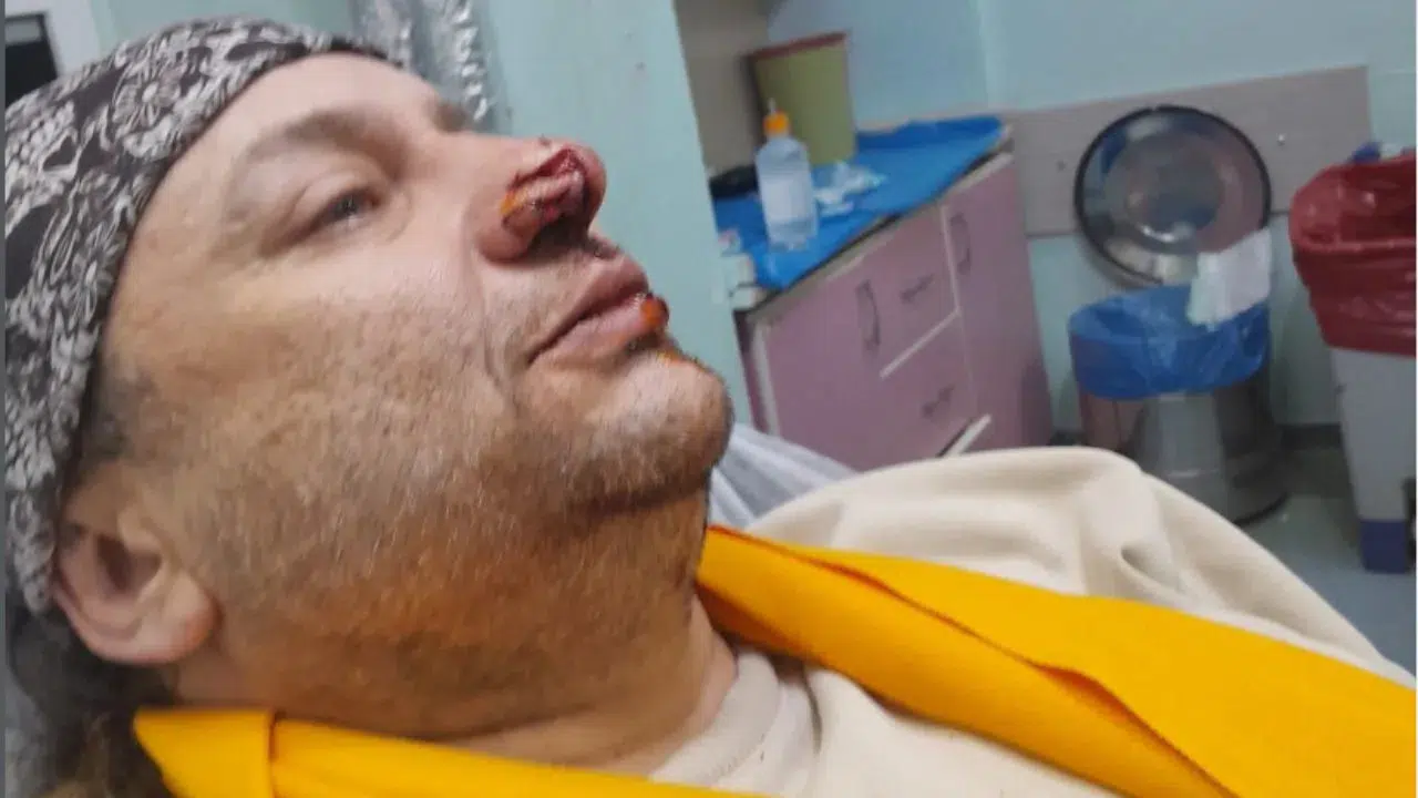 Onur Akay Kimdir? Annesi, babası, kiminle evli ve neden entübe edildi?