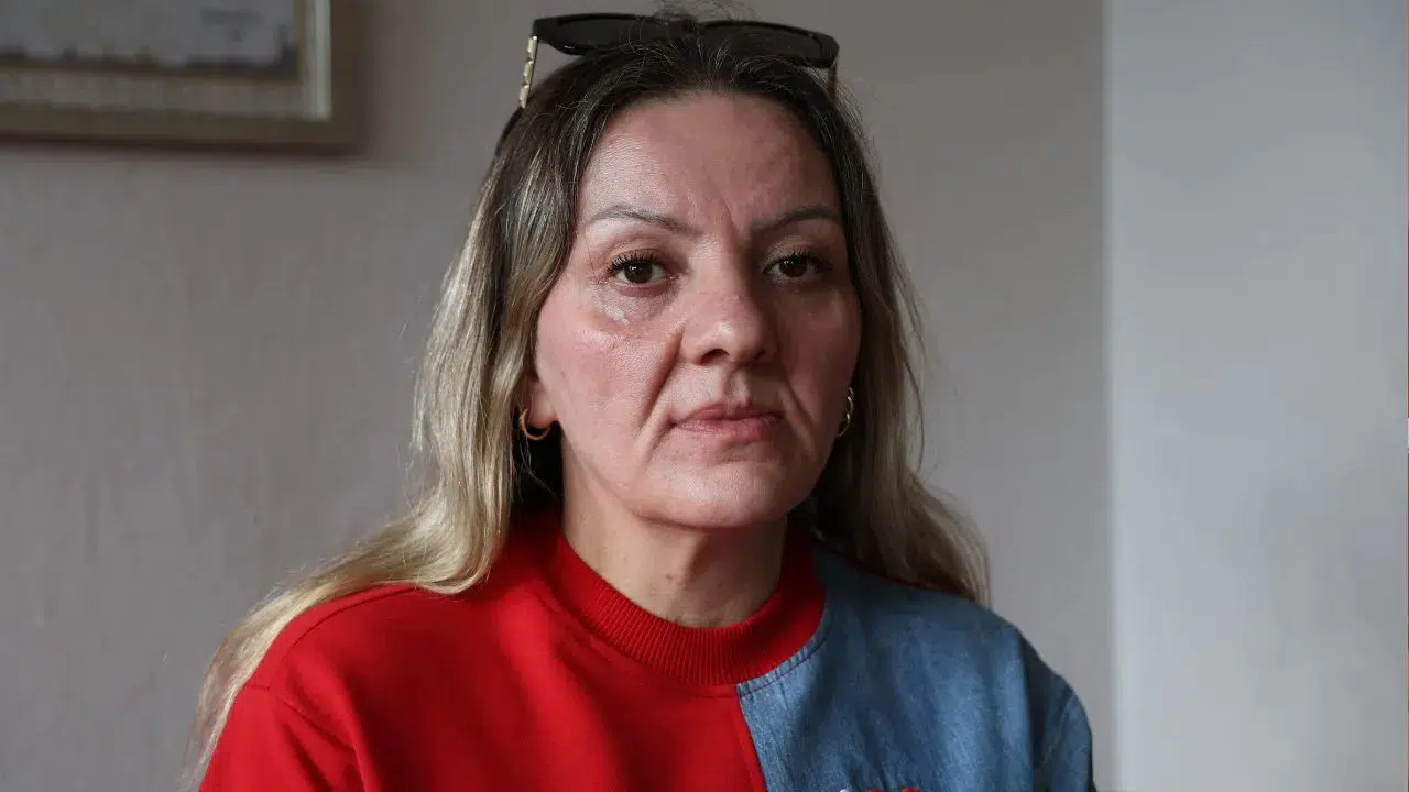 Diş ağrısı şikayetiyle gitti 25 dişinden oldu