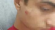 Yine bir akran zorbalığı: Bu defa felaket!