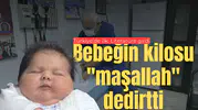 Bebeğin kilosu "maşallah" dedirtti