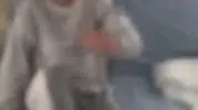 Abisi tarafından yanan kız devlet koruması altında