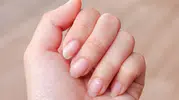 Tırnakta Beyaz Leke Neden Olur? Uzmanlar Açıkladı, Ciddiye Alınmalı!