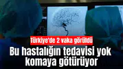 Bu hastalığın tedavisi yok, komaya götürüyor