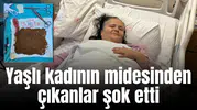 Yaşlı kadının midesinden çıkanlar şok etti