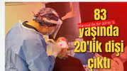 Manisa'da bir garip iş: 83 yaşında 20'lik dişi çıktı
