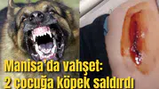 Manisa'da vahşet:2 çocuğa köpekler saldırdı