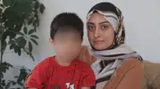 Küçük çocuğun ameliyatta dili ve dudağı yandı