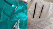 Genç kadının midesinden 2 tane kalem çıkartıldı