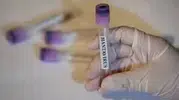 Hantavirüs İçin Aşı Gündeme Geldi! Andes Türü İnsandan İnsana Bulaşabiliyor mu?