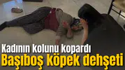 Başıboş köpek dehşeti: Kadının kolunu kopardı