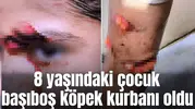 8 yaşındaki çocuk başıboş köpek kurbanı oldu