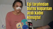 Eşi tarafından burnu koparılan acılı kadın konuştu!