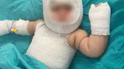 Patlayan konserve 9 aylık bebeğe dehşeti yaşattı