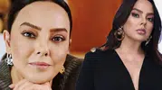 Ebru Gündeş'in milyonlar harcadığı estetik ameliyatı dikkat çekti