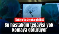 Bu hastalığın tedavisi yok, komaya götürüyor