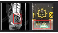 Tomografide şok eden görüntü