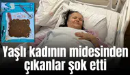 Yaşlı kadının midesinden çıkanlar şok etti
