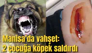 Manisa'da vahşet:2 çocuğa köpekler saldırdı