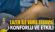 Lazer ile varis tedavisi konforlu ve etkili