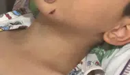 5 yaşındaki çocuk, sokak köpeğinin saldırısına uğradı