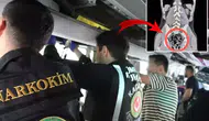 Hastanede çekilen filmdeki detay doktorları bile şaşkına çevirdi