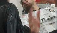 Mahalle maçı kavgaya dönüştü: 2 yaralı