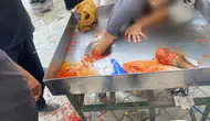 Salça yapma makinesine elini kaptırdı