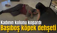 Başıboş köpek dehşeti: Kadının kolunu kopardı