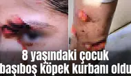 8 yaşındaki çocuk başıboş köpek kurbanı oldu