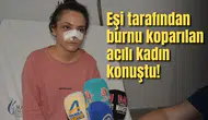 Eşi tarafından burnu koparılan acılı kadın konuştu!