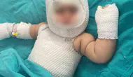 Patlayan konserve 9 aylık bebeğe dehşeti yaşattı