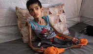 16 yaşındaki Gazzeli İbrahim 7,5 kiloya düştü