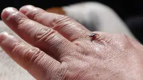 Kene Tehlikesine Karşı Doğal Önlem: Kenelerden Korunmak İçin Bu Kokulara Dikkat!
