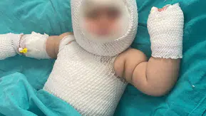Patlayan konserve 9 aylık bebeğe dehşeti yaşattı